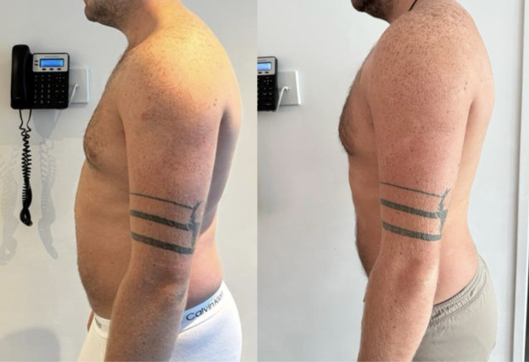 Transformation 3